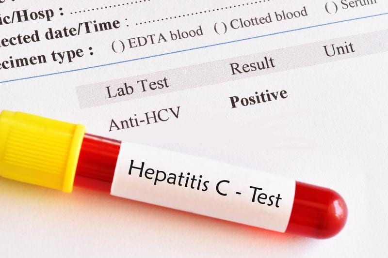 Тест на гепатит c. Hepatitis Test. Blood Test Results. Тест на гепатит с. Positive Reactive Hepatitis b Titer Lab Report.