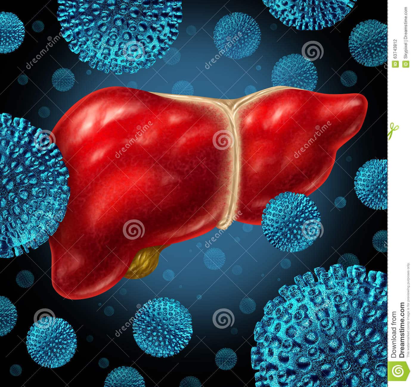 Hepatitis Liver Infection stock illustration. Illustration of health ...